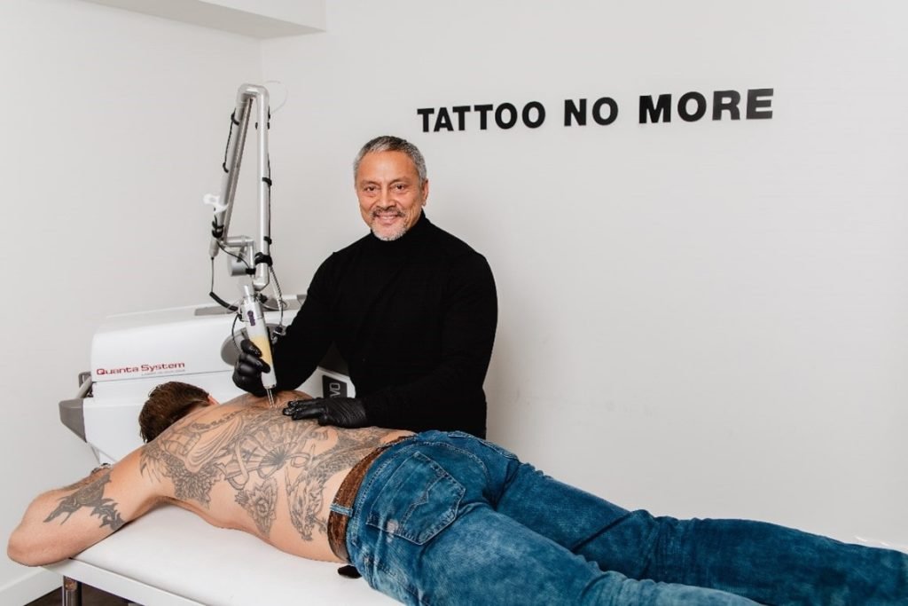 Tattoo laten verwijderen in Rotterdam
